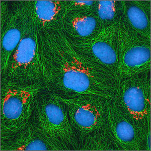 fluorescence-microscope2