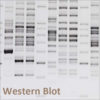 Western Blot