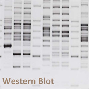 Western Blot